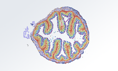 时空单细胞支持计划-买时空送测序/单细胞